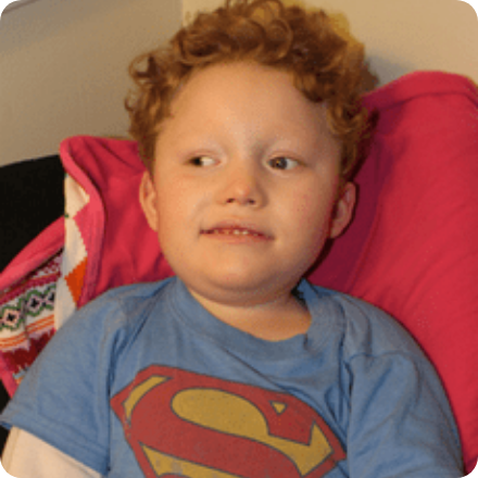 Lissencephaly