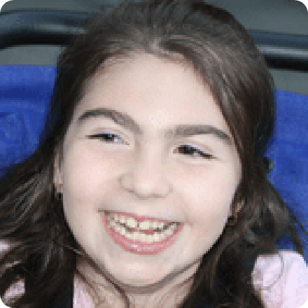 Athetoid Cerebral Palsy