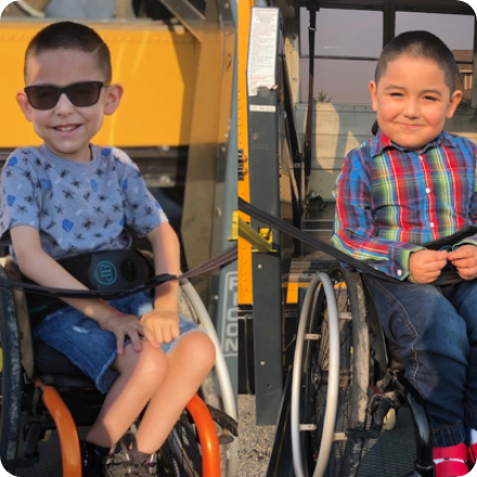 Spinal Muscular Atrophy (SMA)