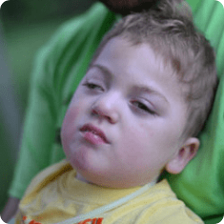 Cerebral Palsy (CP)